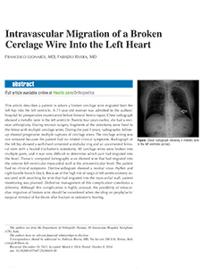 Intravascular-migration-of-a-broken-cerclage-wire-into-the-left-heart